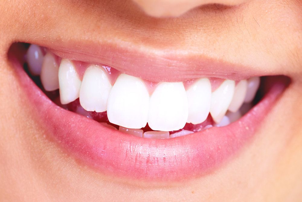 image of smile with porcelain veneers
